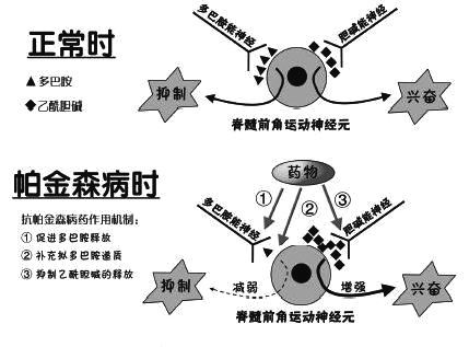 rTMS经颅磁仪_帕金森的认识误区是什么