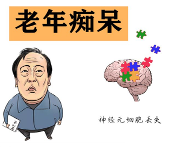 择思达斯经颅仪家用品牌_老年痴呆发生的根源是什么